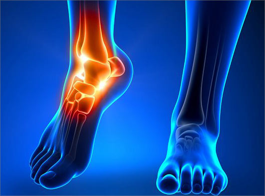 عکس با کیفیت از اسکن استخوان مچ پا و درد مچ پا