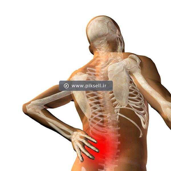عکس با کیفیت از اسکن بدن و کمر درد
