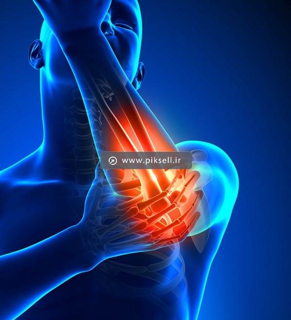 عکس با کیفیت از اسکن استخوان آرنج و درد