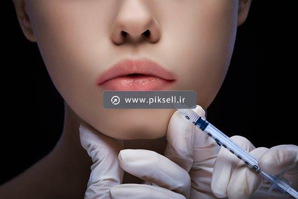دانلود عکس با کیفیت از تزریق ژل حجم دهنده به لب