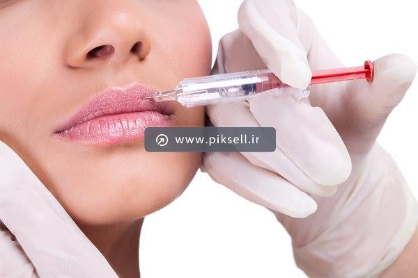 عکس با کیفیت از تزریق ژل به لب و زیبایی صورت و بوتاکس